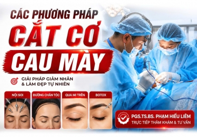 Các phương pháp cắt cơ cau mày và những điều cần biết