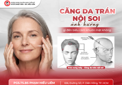 Căng da trán nội soi có ảnh hưởng gì đến biểu cảm khuôn mặt không?