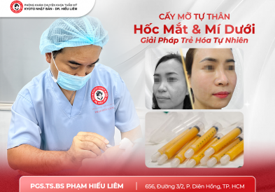 Cấy Mỡ Hốc Mắt Và Mí Dưới – Giải Pháp Trẻ Hóa Tự Nhiên Cho Vùng Mắt Trũng Sâu, Thâm Quần
