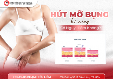 Hút Mỡ Bụng Bị Cứng Có Nguy Hiểm Không?