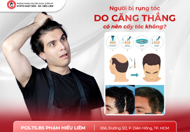 Người bị rụng tóc do căng thẳng có nên cấy tóc không?