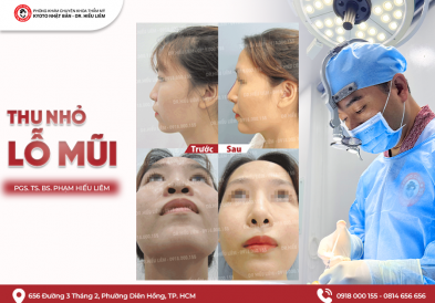 Thu nhỏ lỗ mũi