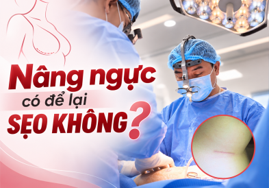 Sẹo sau nâng ngực – Nâng ngực có để lại sẹo không?