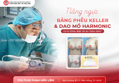   Nâng Ngực Bằng Phễu Keller Và Dao Mổ Harmonic: Có Gì Khác Biệt Và An Toàn Hơn?