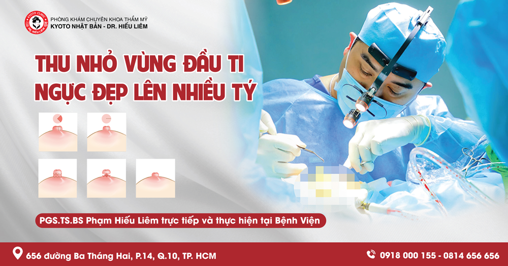 Ai là đối tượng phù hợp để thực hiện thu gọn núm vú?
