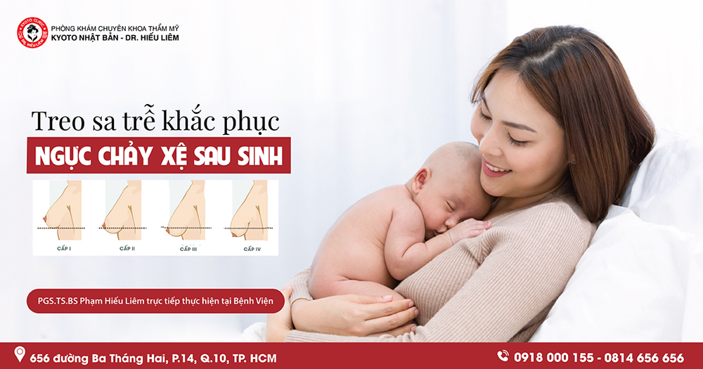 ngực xệ cách khắc phục