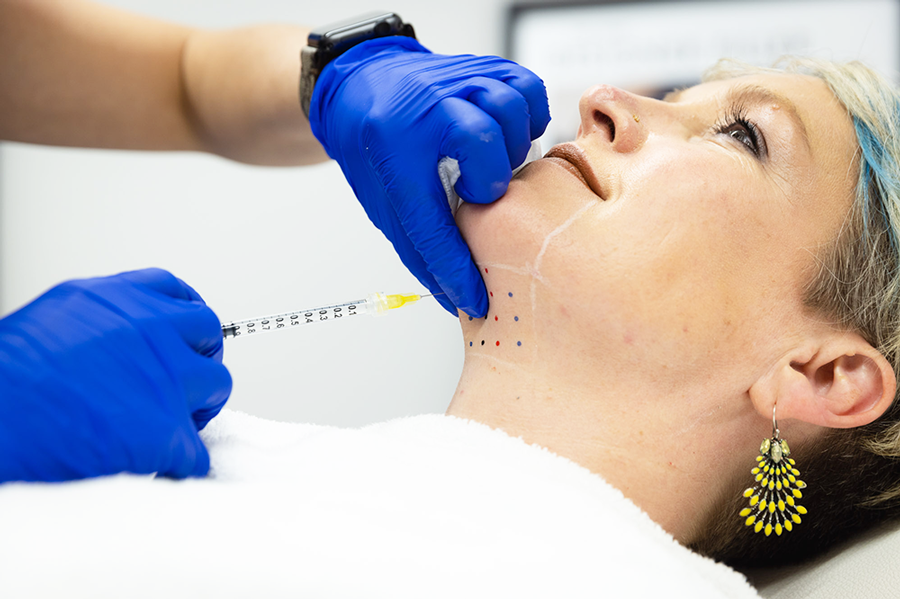 TIÊM TAN MỠ NỌNG CẰM BẰNG BOTOX GIÚP CẢI THIỆN ĐƯỜNG NÉT KHUÔN MẶT RÕ RỆT