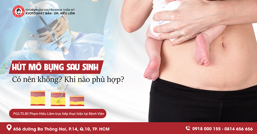 6. Những Rủi Ro Cần Lưu Ý Khi Hút Mỡ Bụng Sau Sinh