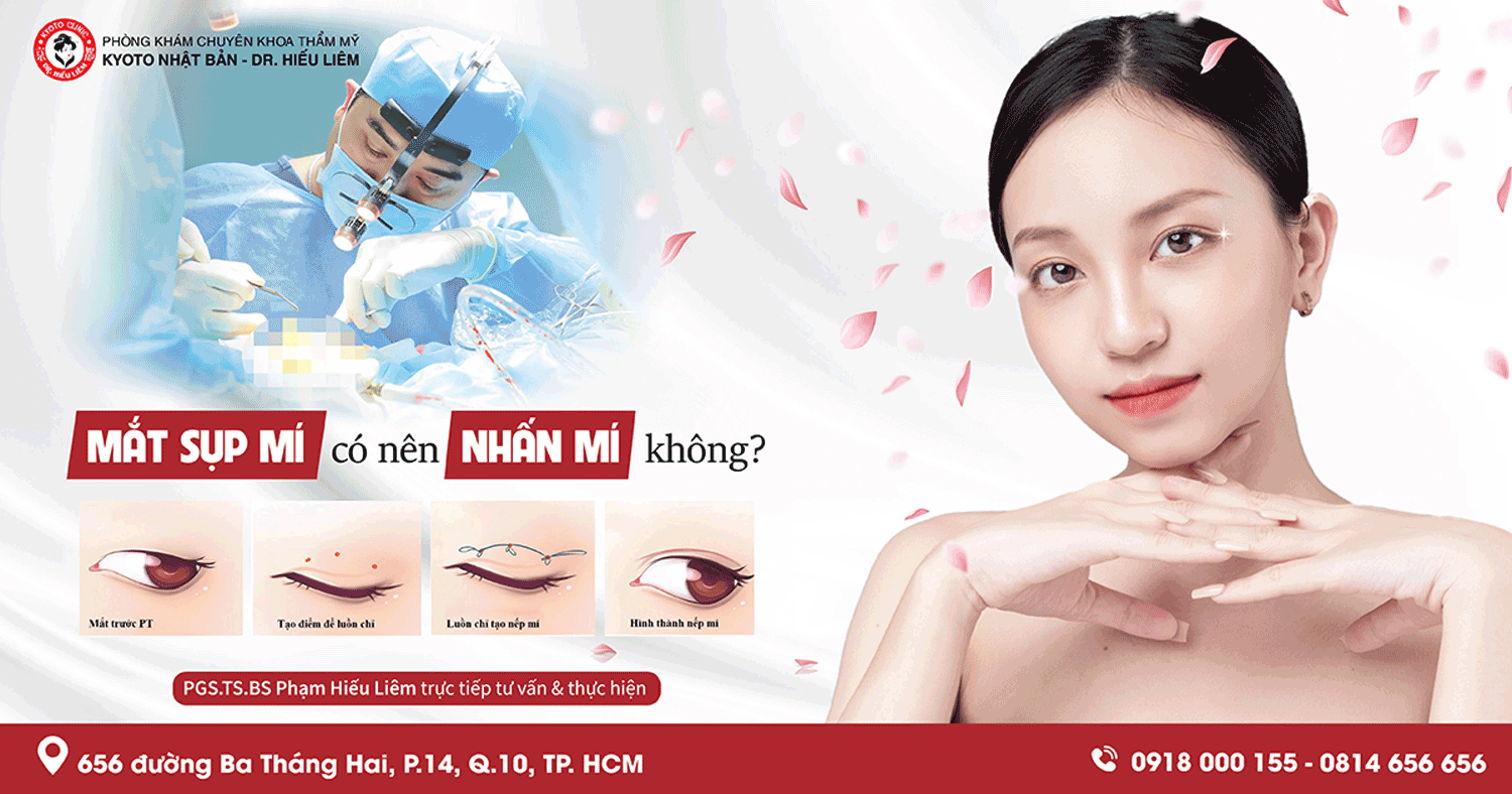 Mắt Sụp Mí Có Nên Nhấn Mí Không? - Dr. Hiếu Liêm