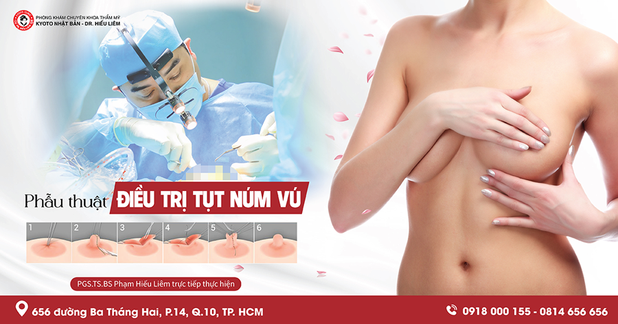 Tỉ lệ thành công và những lưu ý về phẫu thuật núm vú cho phụ nữ