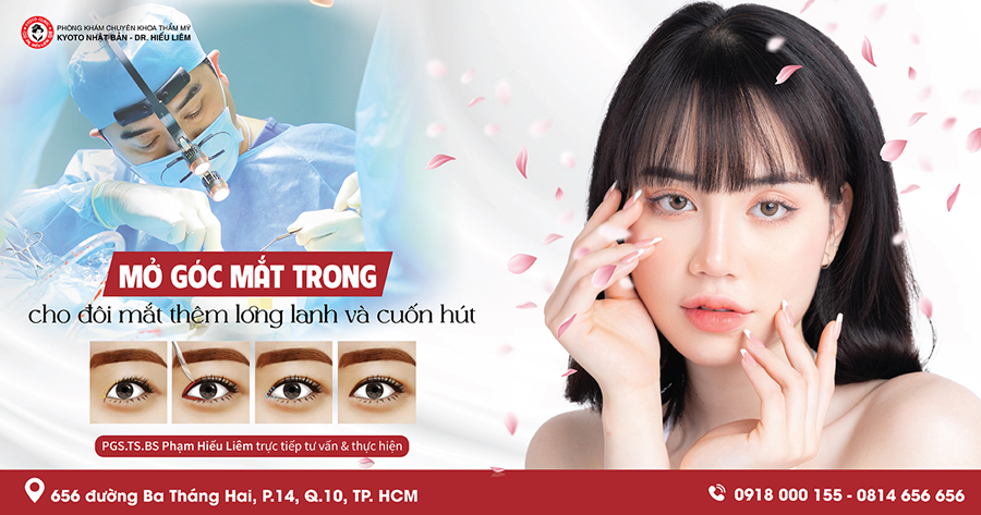 Mở góc mắt trong - PGS.TS.BS Phạm Hiếu Liêm