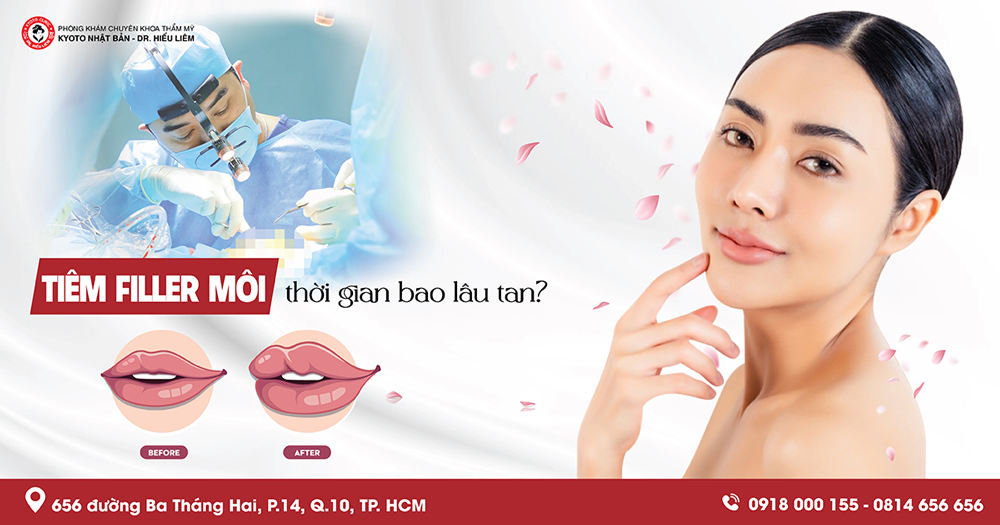 Các Câu Hỏi Thường Gặp Về Tiêm Filler Môi