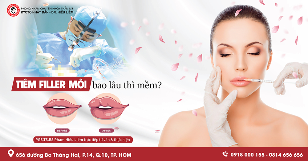 Tiêm filler bao lâu thì mềm? Tất cả bạn cần biết!