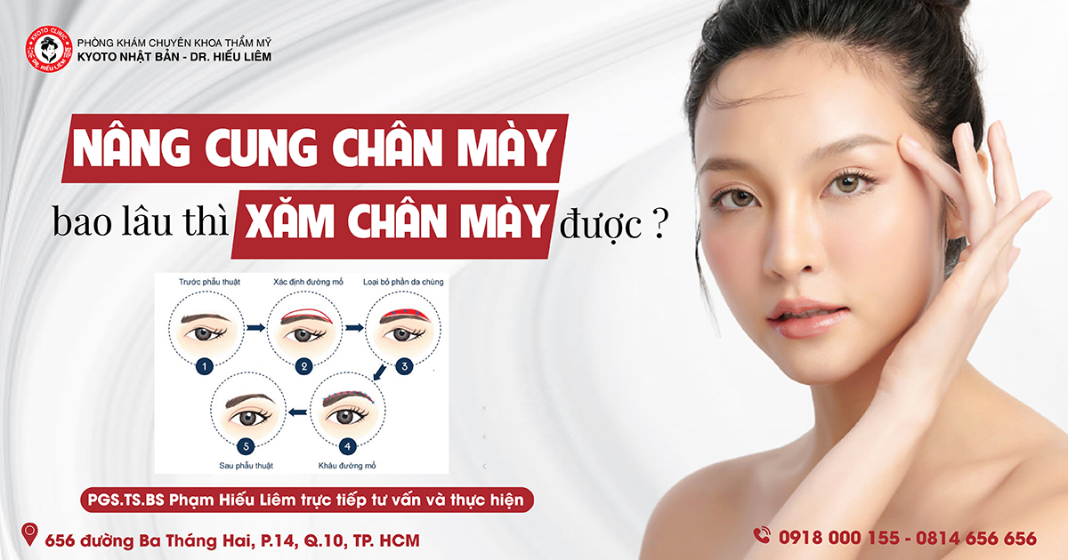 Nâng cung mày - xăm cung mày sau nâng cung mày
Nâng cung mày là phương pháp giúp cải thiện độ đàn hồi và nâng cao vẻ đẹp của gương mặt. Sau khi thực hiện nâng cung mày, bạn có thể xăm cung mày để tôn lên vẻ đẹp tự nhiên và hài hòa của khuôn mặt. Để đảm bảo kết quả xăm cung mày đẹp nhất, hãy lựa chọn nghệ sĩ uy tín và có chuyên môn cao trong lĩnh vực này.