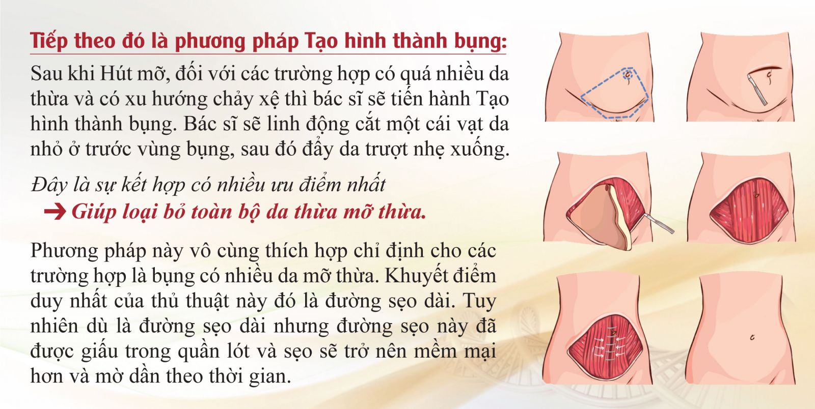 phuong-phap-tao-hinh-thanh-bung