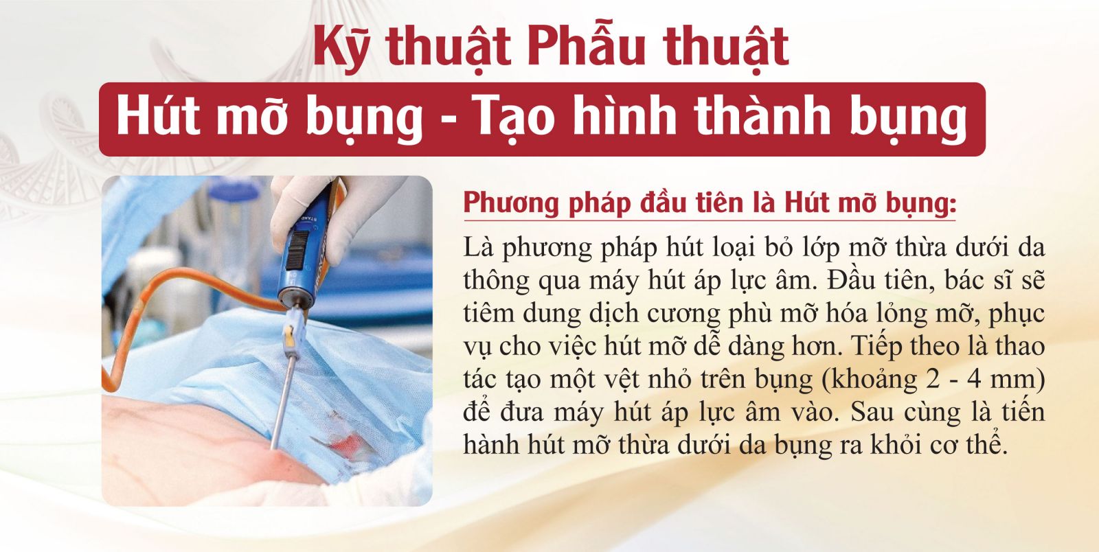 phuong-phap-dau-tien-la-hut-mo-bung