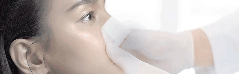 Cách chăm sóc sau nâng mũi cấu trúc sụn tai