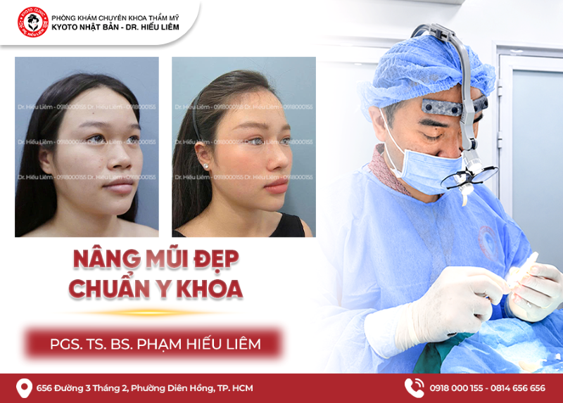 Nâng mũi ở đâu đẹp tại TP.HCM - BS Hiếu Liêm Thẩm mỹ Kyoto