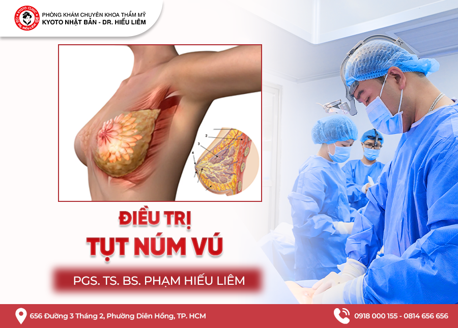 Phẫu thuật điều trị tụt núm vú bởi bác sĩ Hiếu Liêm - Thẩm mỹ Kyoto
