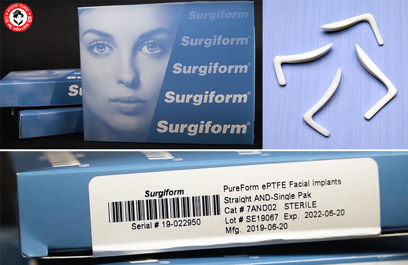 Sụn nâng mũi Surgiform có gây dị ứng sau nâng mũi không - Thẩm mỹ Kyoto BS Hiếu Liêm