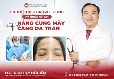 Endoscopic Brow Lifting - Kỹ thuật nội soi giúp vừa nâng cung mày vừa căng da trán