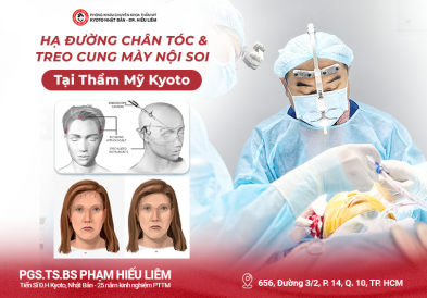 Phẫu thuật hạ đường chân tóc
