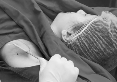 Hôi nách ở tuổi dậy thì