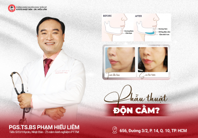 PHẪU THUẬT ĐỘN CẰM