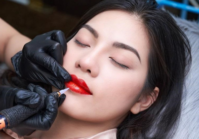 Môi tiêm filler có phun được không?