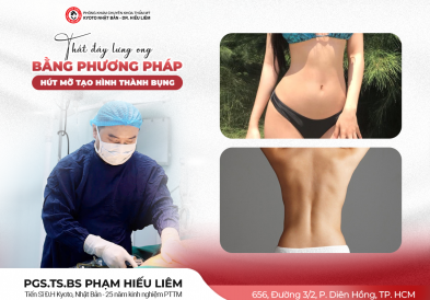 Thắt đáy lưng ong bằng phương pháp hút mỡ tạo hình thành bụng