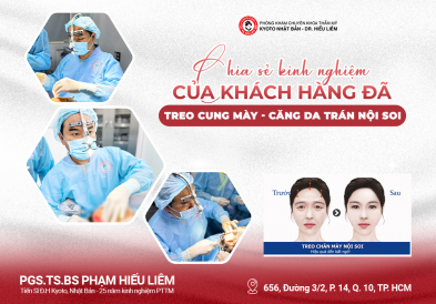 Chia sẻ kinh nghiệm của khách hàng đã treo cung mày - Căng da trán nội soi