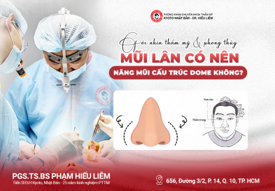 Mũi lân có nên nâng mũi cấu trúc DOME không?